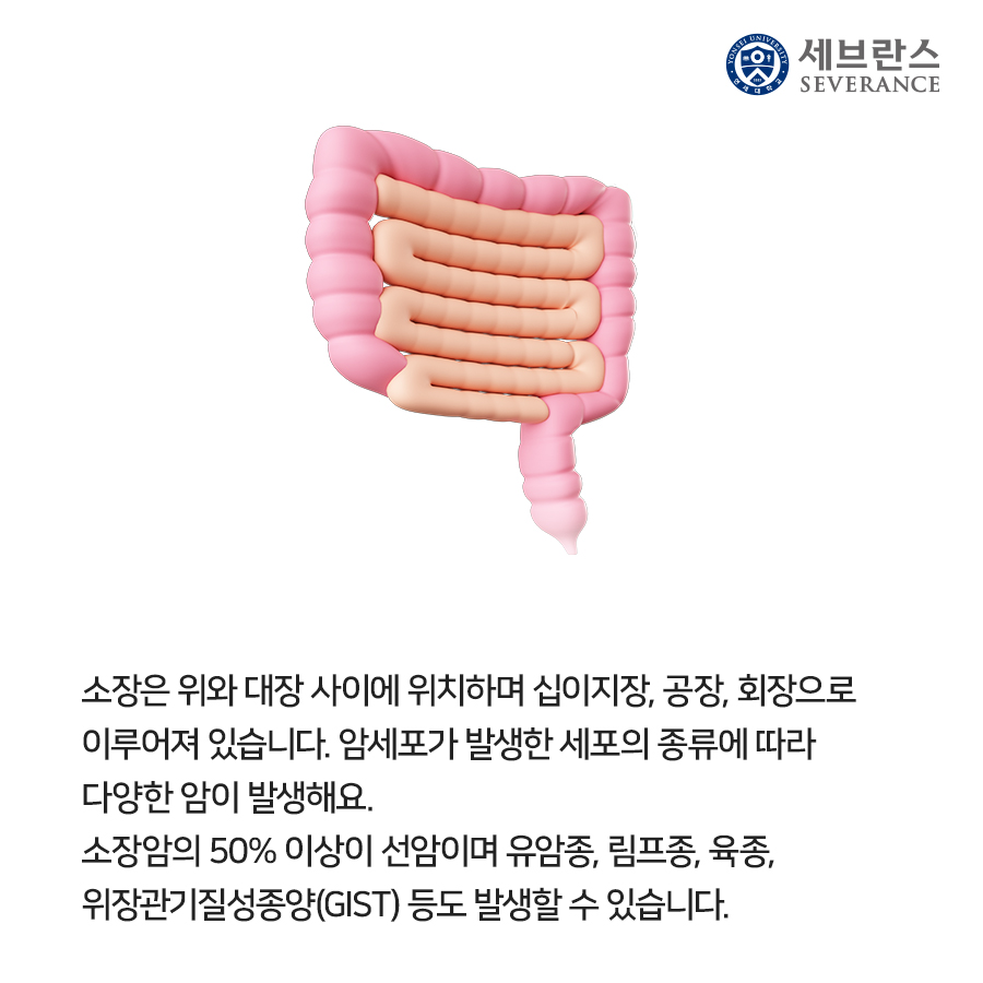 소장은 위와 대장 사이에 위치하며 십이지장, 공장, 회장으로 이루어져 있습니다. 암세포가 발생한 세포의 종류에 따라 다양한 암이 발생해요. 소장암의 50% 이상이 선암이며 유암종, 림프종, 육종, 위장관기질성종양(GIST) 등도 발생할 수 있습니다.